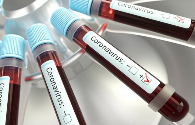 Diyabet ilacı koronavirüse bağlı ölümleri önlüyor!